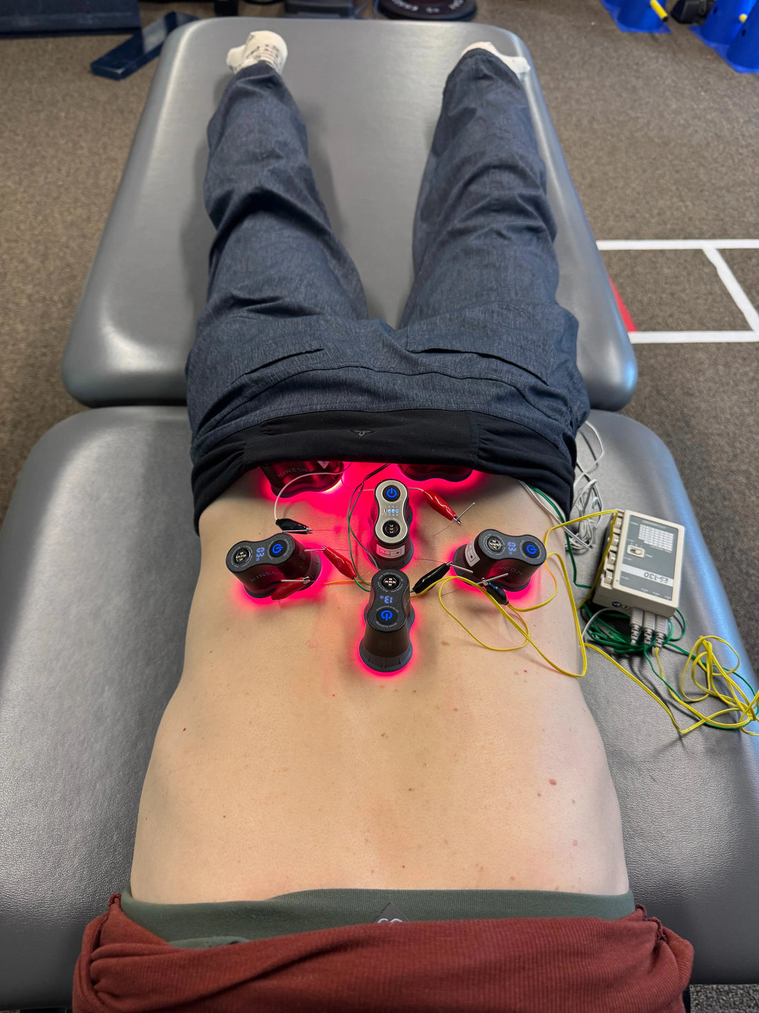 Red Light Therapy With Dry Needling - Kineon